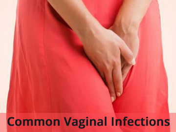 Common vaginal infections and their symptoms Treatment at Infertility Centres in Delhi