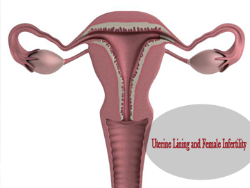 Uterine Lining and Infertility
