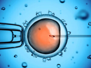 Common-IVF-Myths-Misconceptions