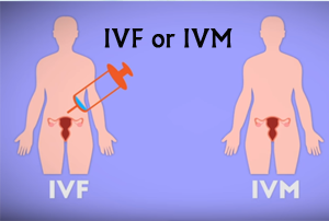 IVF-IVM