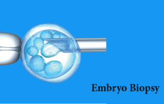 embryo biopsy