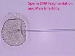 Sperm-DNA-Fragmentation-and-Male-Infertility