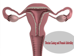 Uterine-Lining-and-Infertility