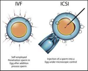 what is difference between ICSI and IVF