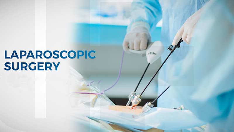Crucial facts to know before undergoing laparoscopic surgery in India