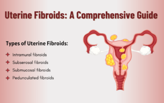 Uterine Fibroids: Causes, Symptoms, Types, and Treatment
