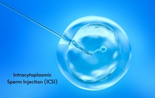 Intracytoplasmic Sperm Injection (ICSI) (1)